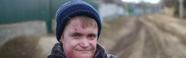 Евгений Брад: Мы боремся с болезнью, чтобы жить!
